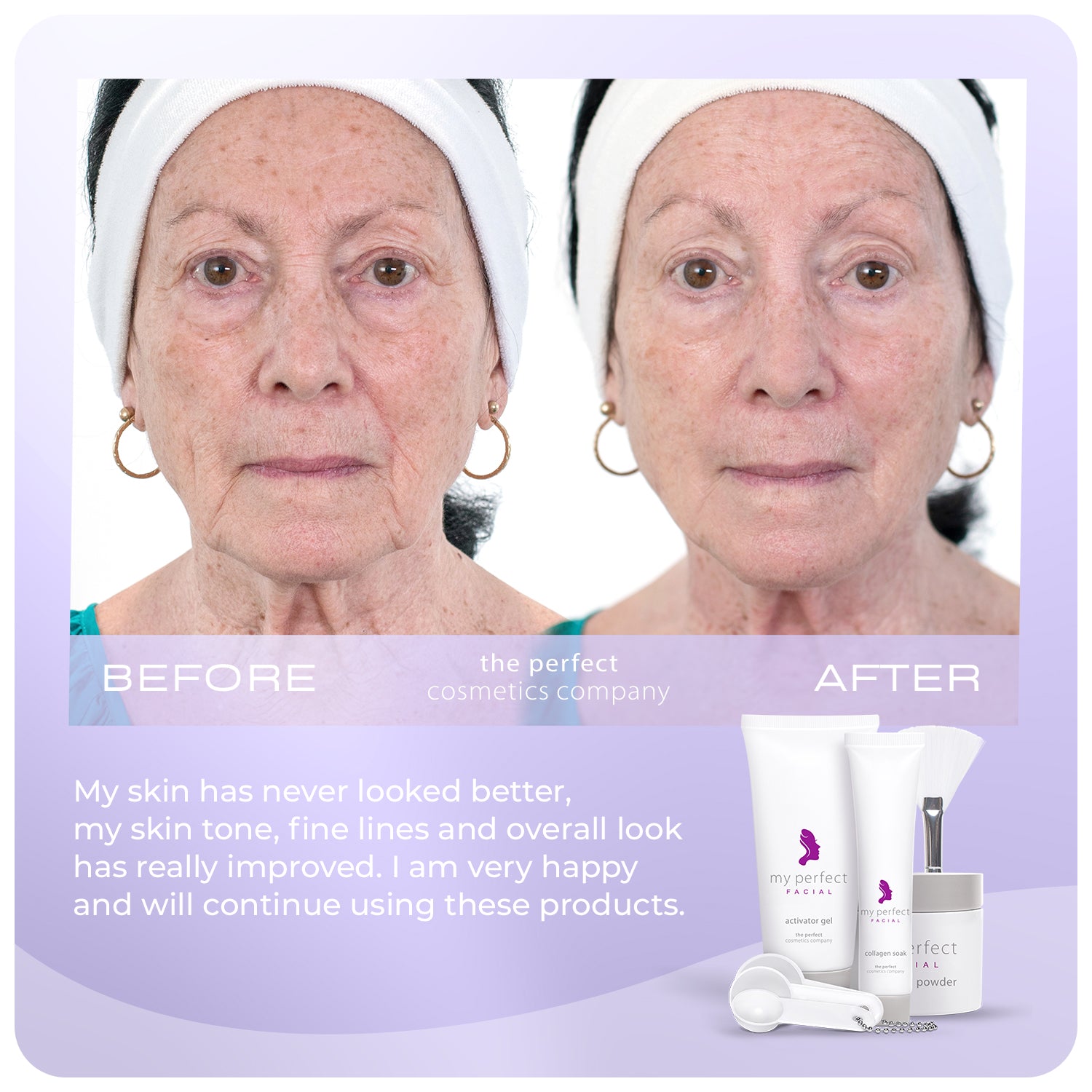 My Perfect Facial 10 Treatments